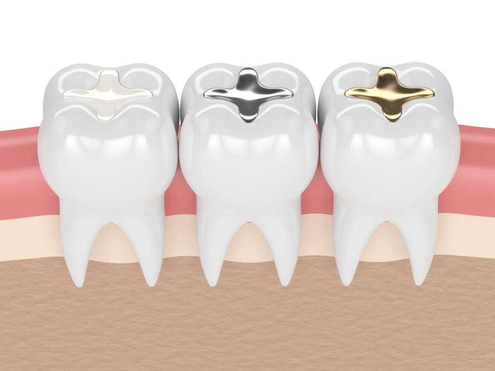 differences of filling materials