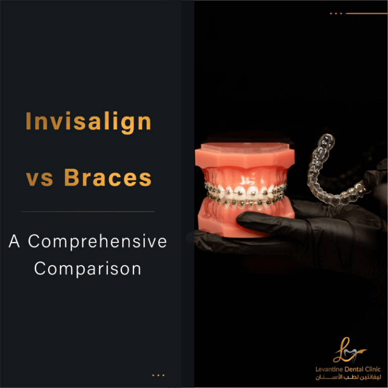 Invisalign vs Braces
