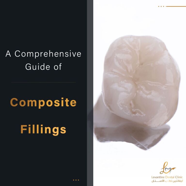 Types of Dental Fillings