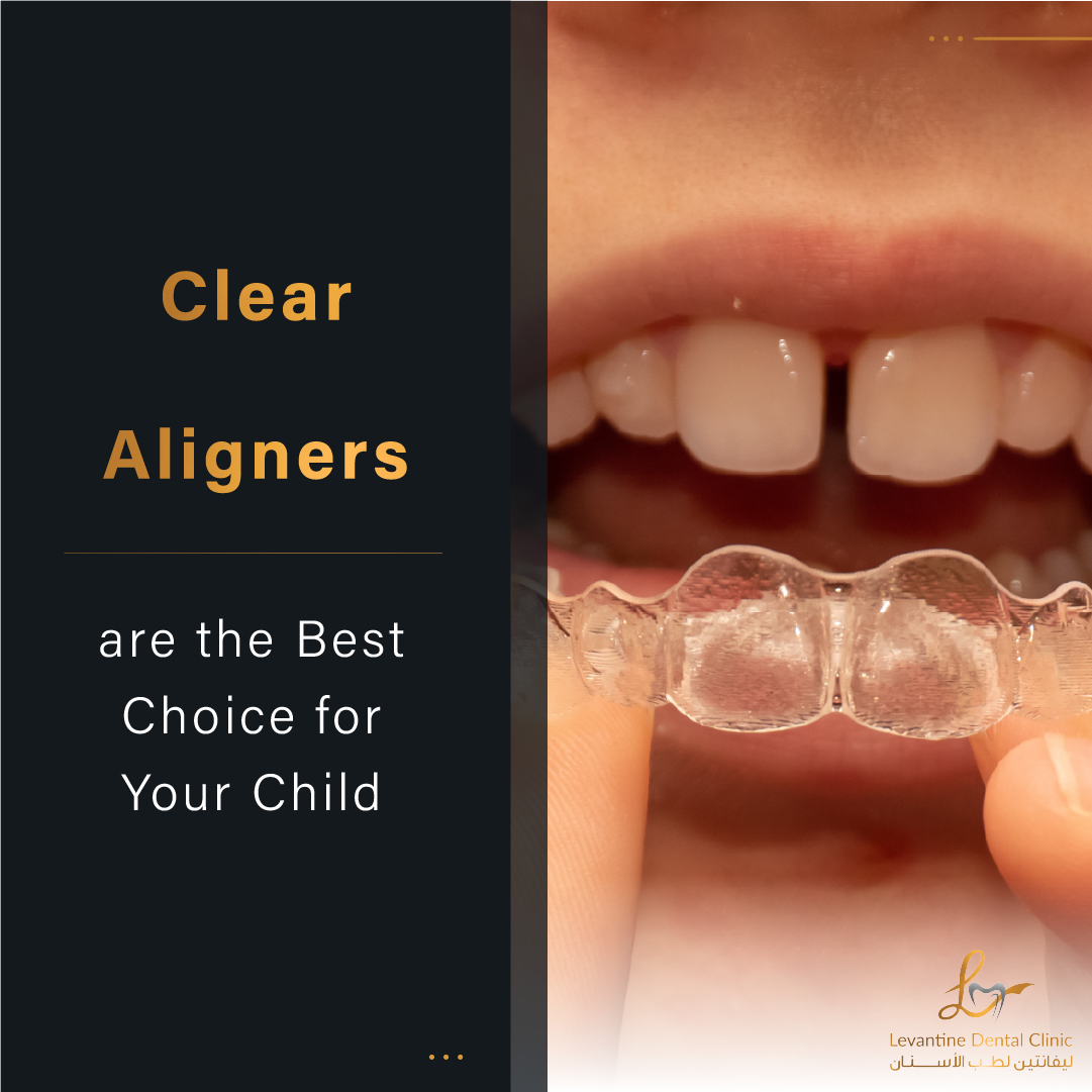 Why Clear Aligners are the Best Choice for Your Child&rsquo;s Orthodontic Treatment