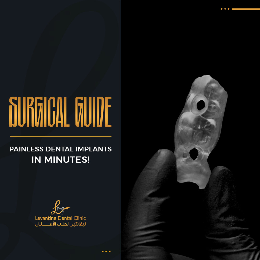 Surgical Guide ENG blog