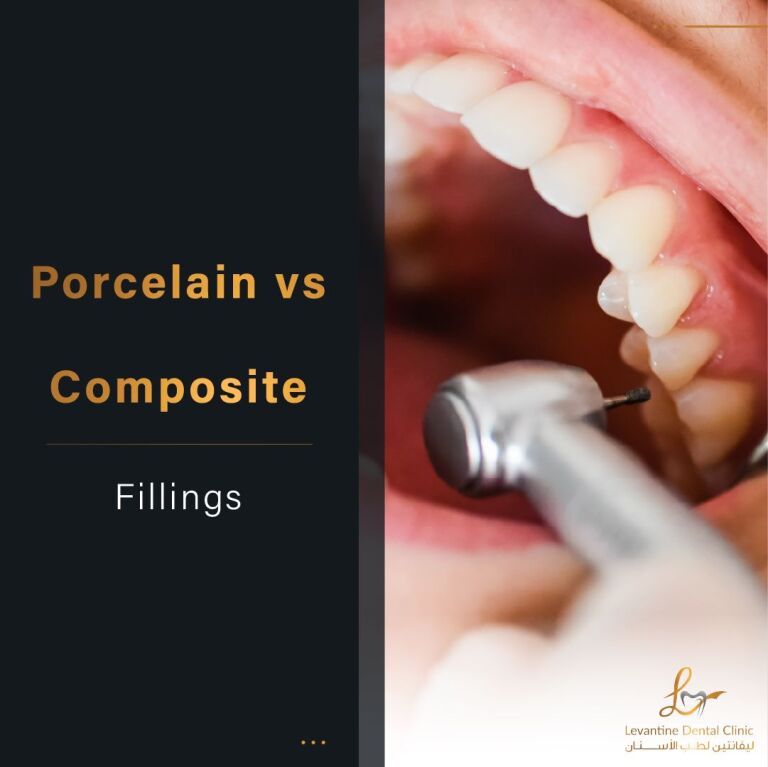 Porcelain vs Composite Fillings