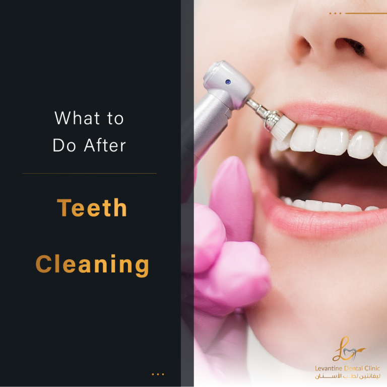 After Teeth Cleaning