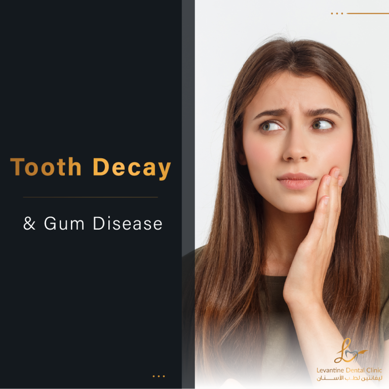 Tooth Decay and Gum Disease