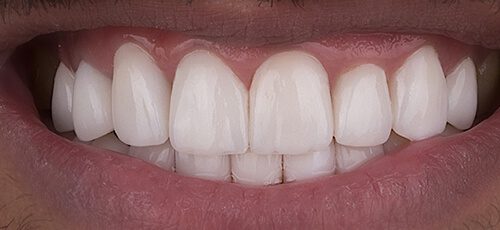Case 10 - After