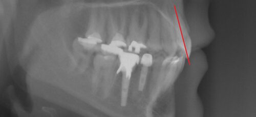 Case 14 - After
