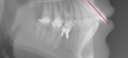 Case 14 - Before