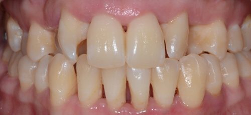 Case 15 - Before