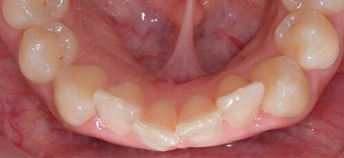 Case 1 - Before