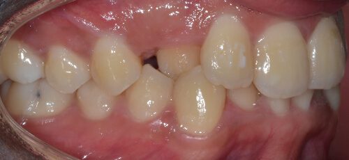 Case 2 - Before