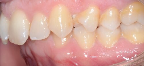 Case 21 - Before