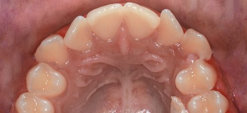 Case 27 - Before