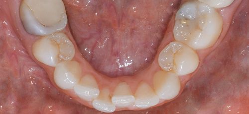 Case 29 - After
