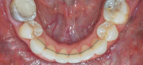 Case 29 - Before