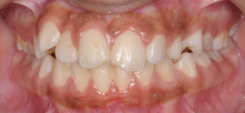 Case 3 - Before