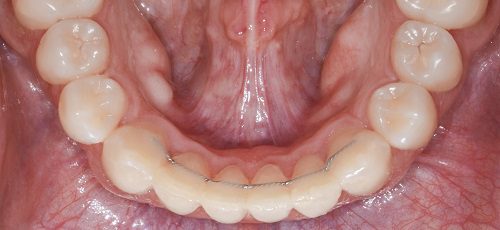 Case 34 - Before