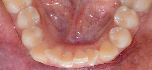 Case 37 - Before