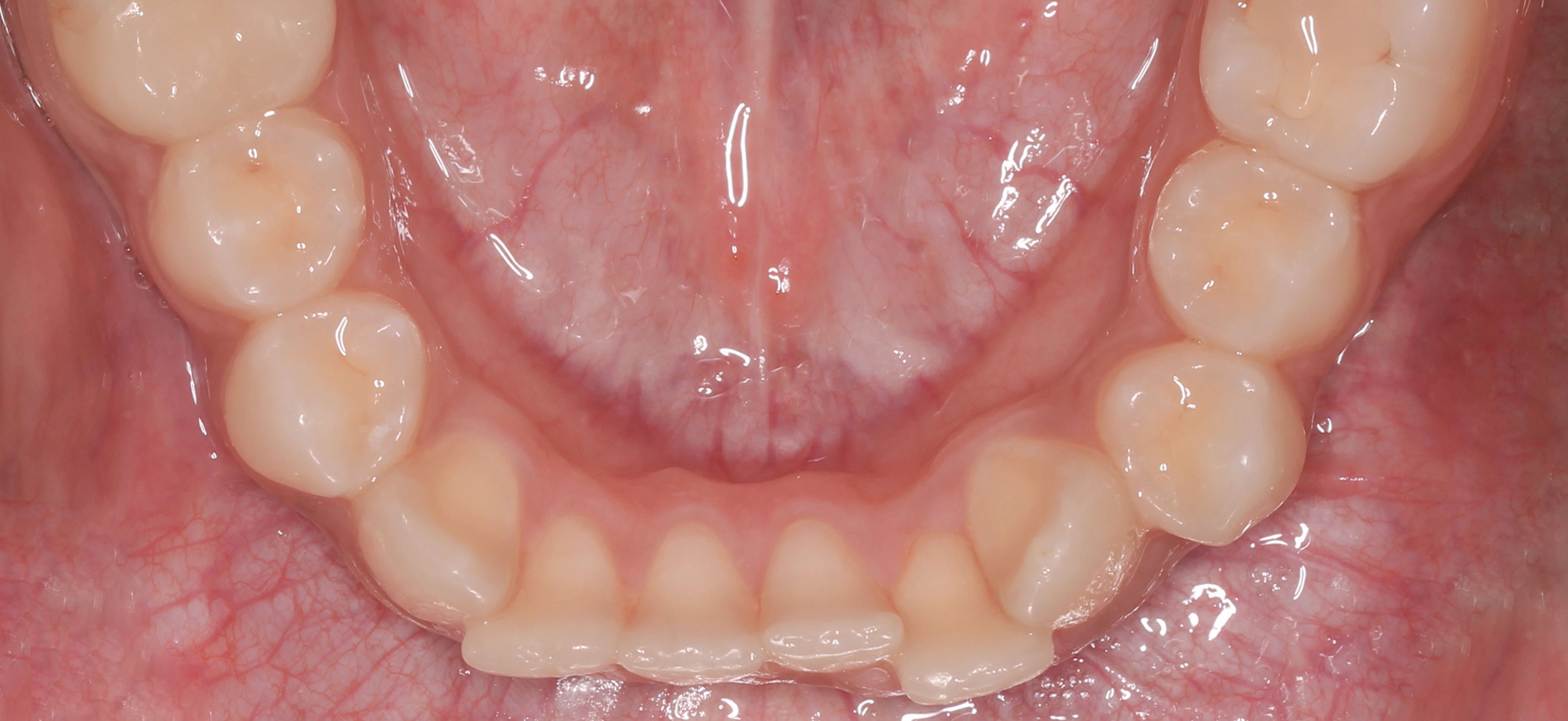 Case 40 - After