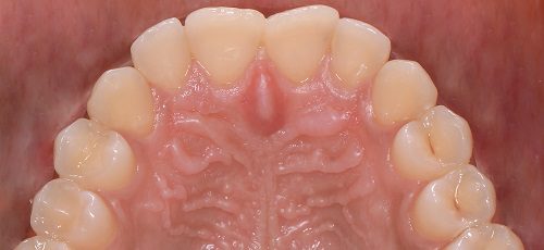 Case 41 - Before