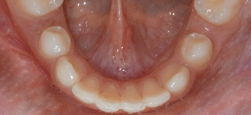 Case 43 - After