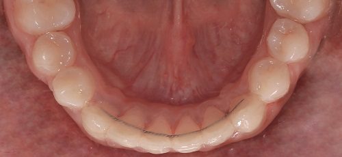 Case 43 - Before