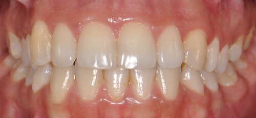 Case 7 - Before