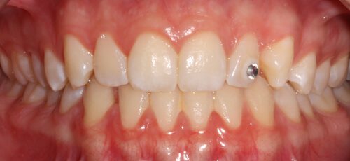 Case 8 - Before