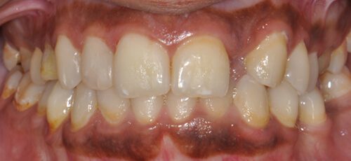 Case 9 - Before