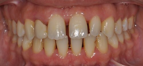 Case 1 - Before