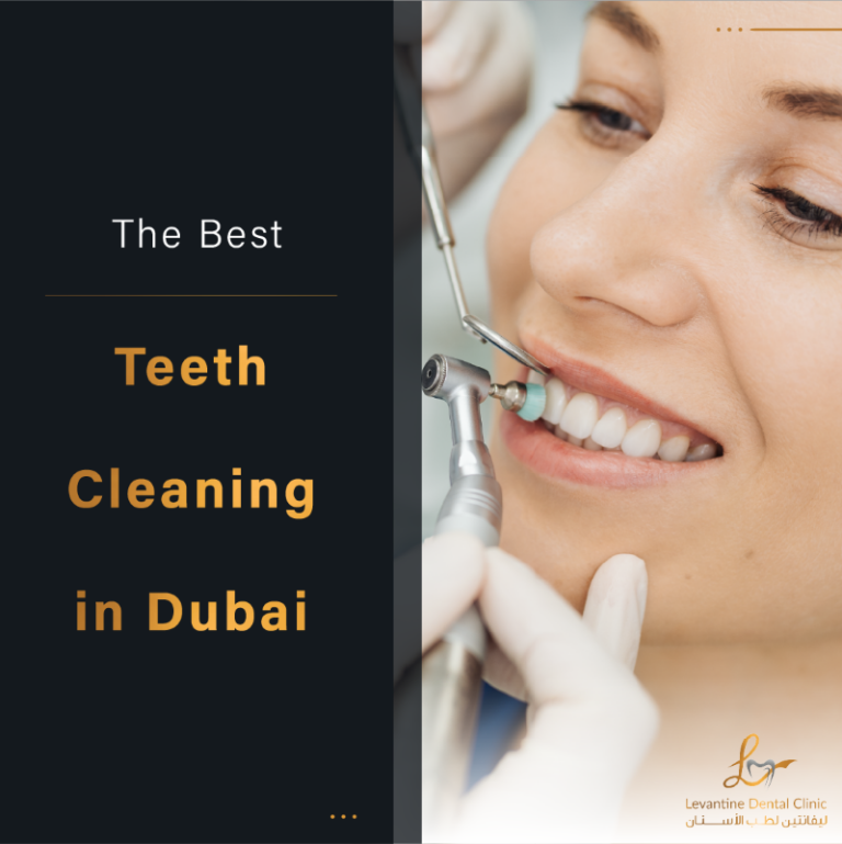 Teeth Cleaning in Dubai