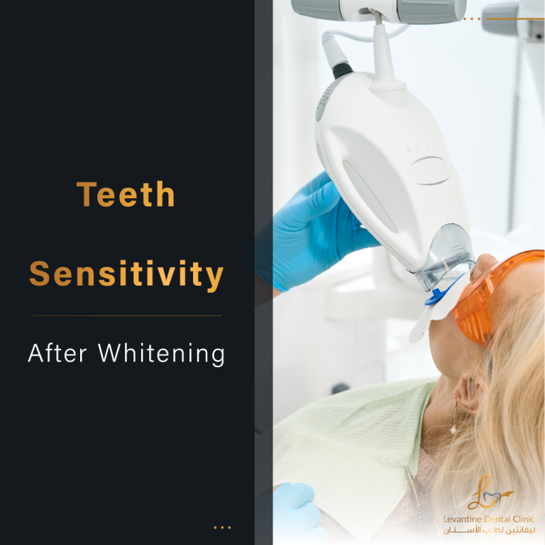 Teeth Sensitivity After Whitening