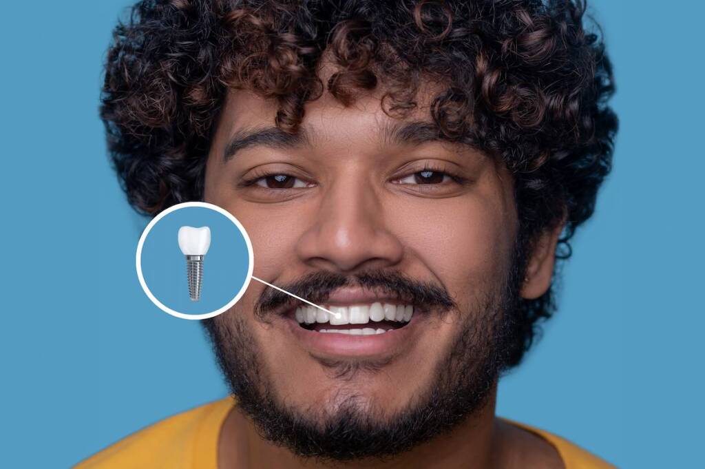Dental Implants in Dubai