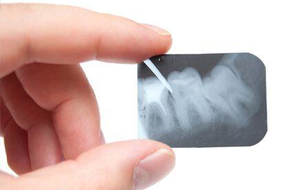 Bony Area Health