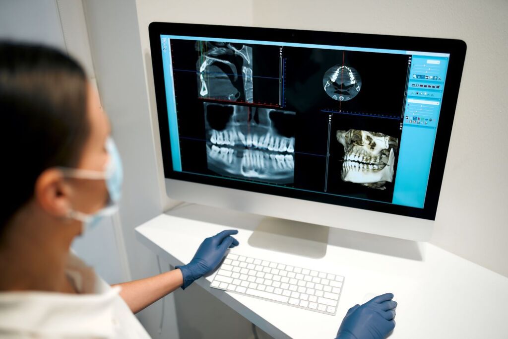 CBCT X-Ray