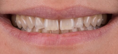 Case 34 - Before