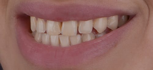 Case 18 - Before