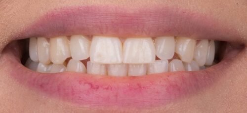 Case 35 - Before