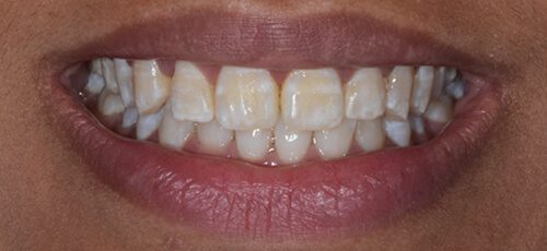 Case 21 - Before