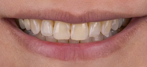 Case 4 - Before