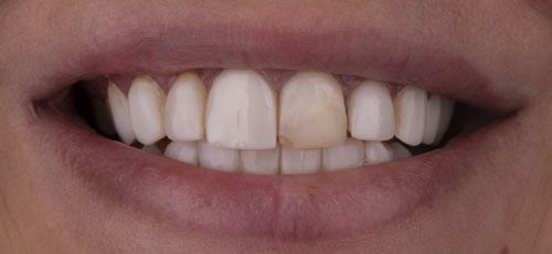 Case 33 - Before