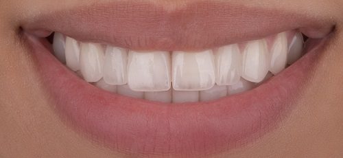 Case 7 - Before