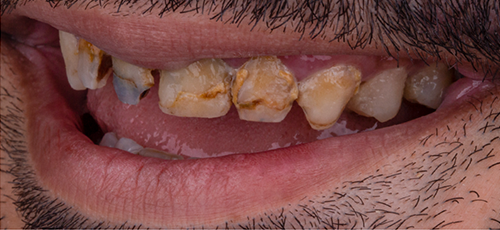 Case 10 - Before