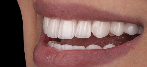 Case 14 - Before