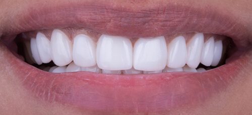 Case 30 - After
