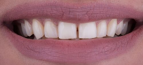 Case 30 - Before