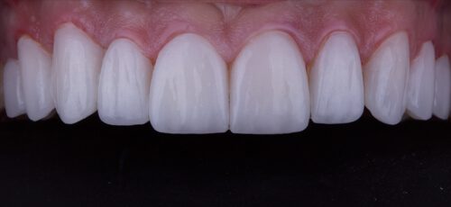 Case 25 - After