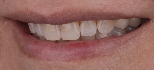 Case 19 - Before
