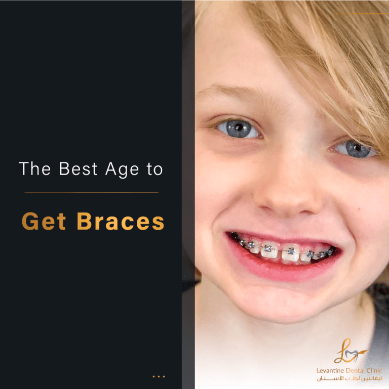 The Age to Get Braces