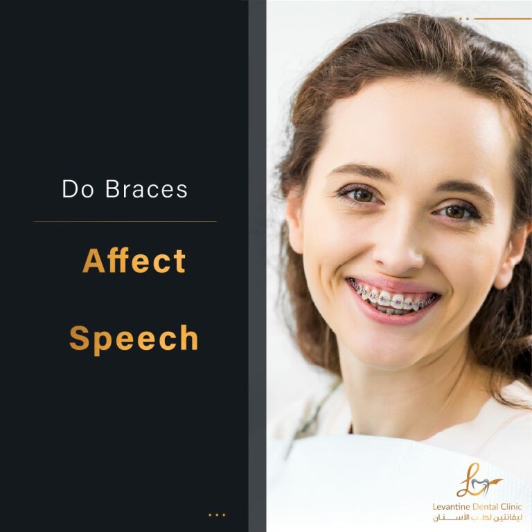Do Braces Affect Speech?