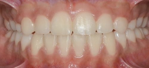 Case 2 - After